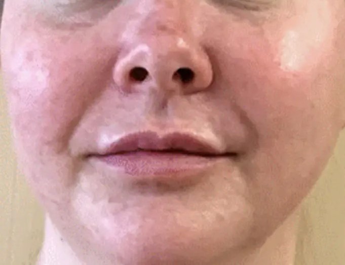 Processed - Woman's face