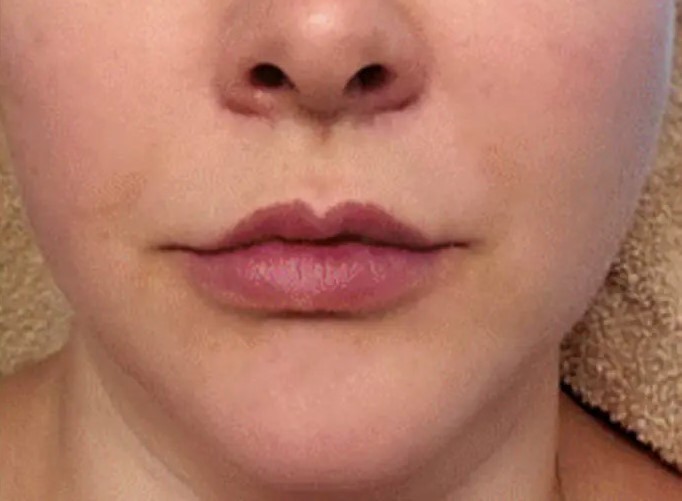 Original - Woman's face