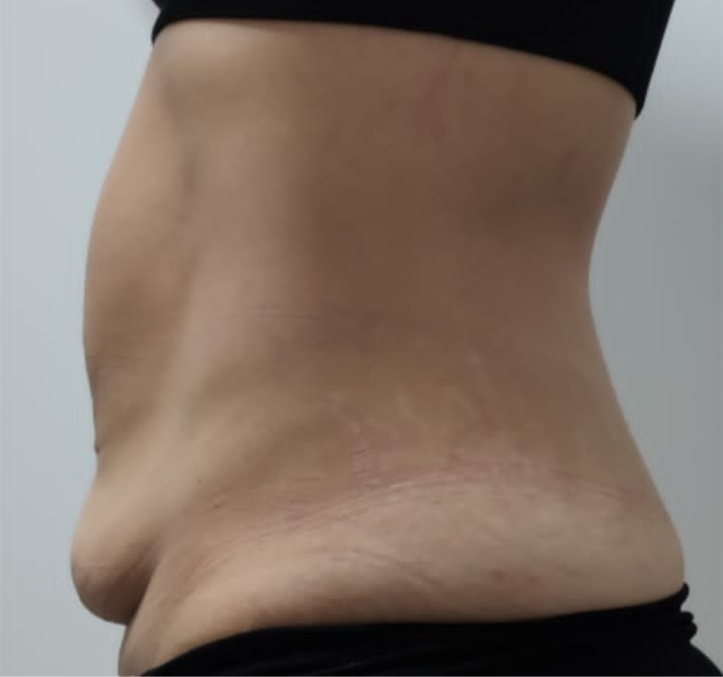 Processed - Woman's face