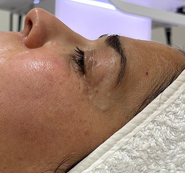 Original - Woman's face